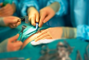 getty_rf_photo_of_surgery_in_progress